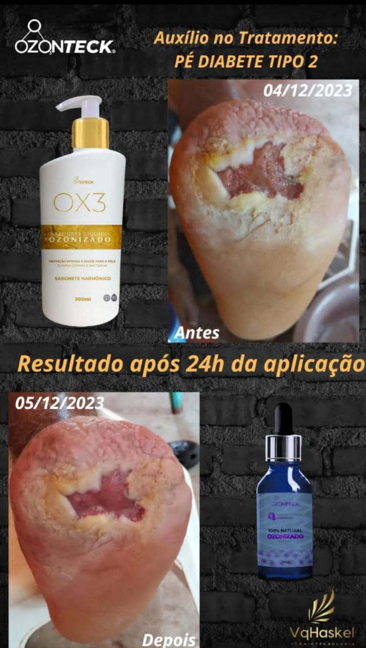 Antes e depois cliente 1